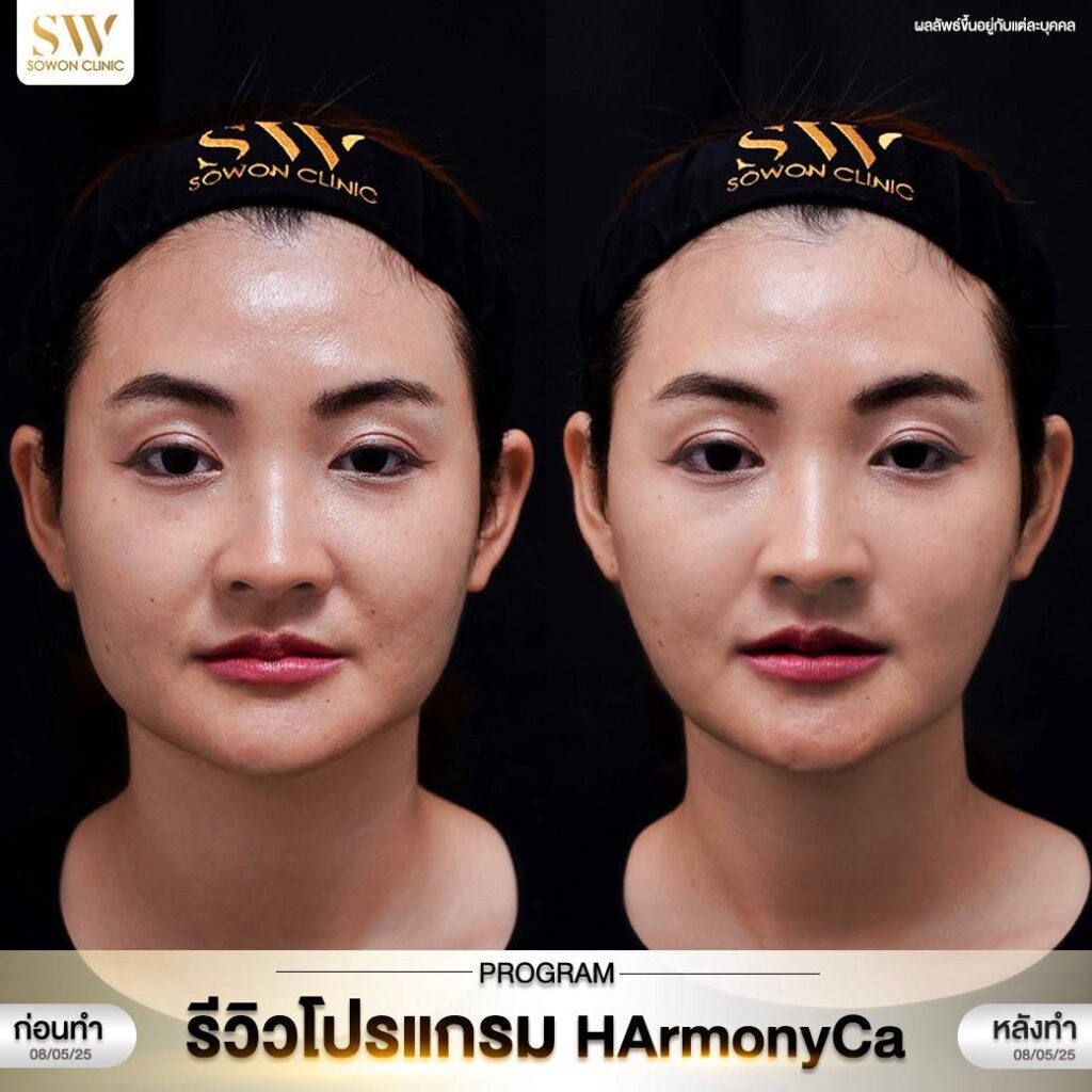 โปรแกรม HArmonyCa คุณบิว05
