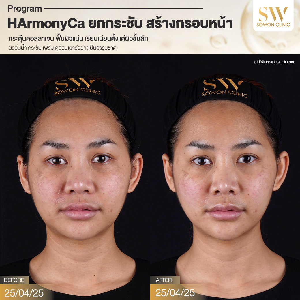 โปรแกรม HArmonyCa รีวิว002