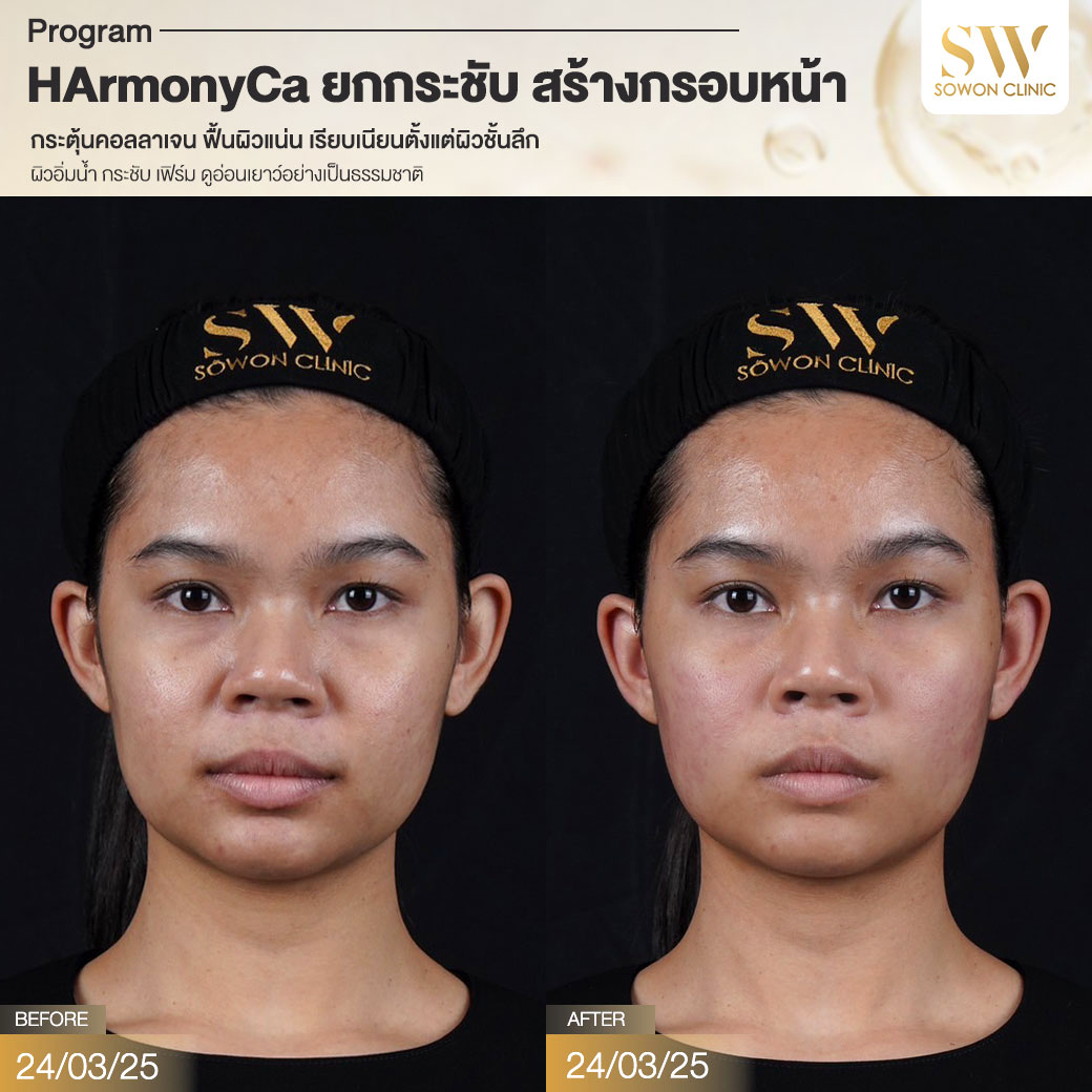 โปรแกรม HArmonyCa รีวิว004