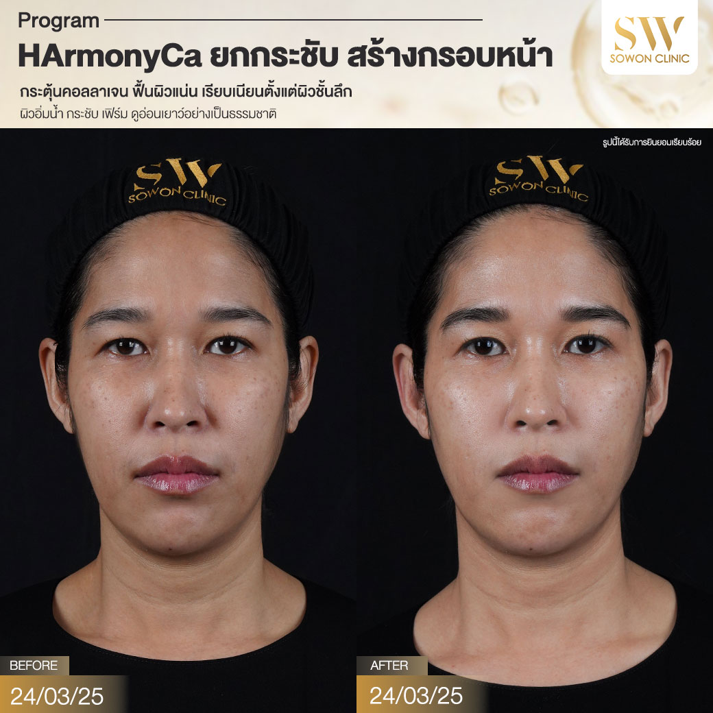 โปรแกรม HArmonyCa รีวิว005
