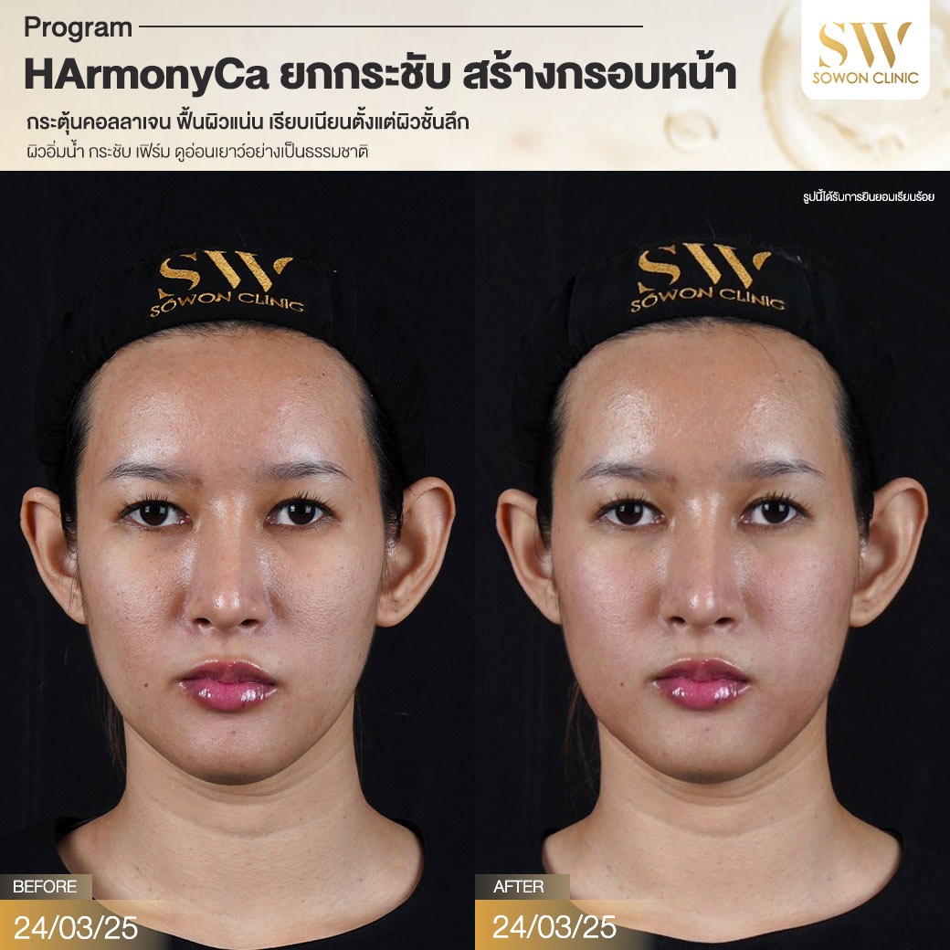 โปรแกรม HArmonyCa รีวิว006