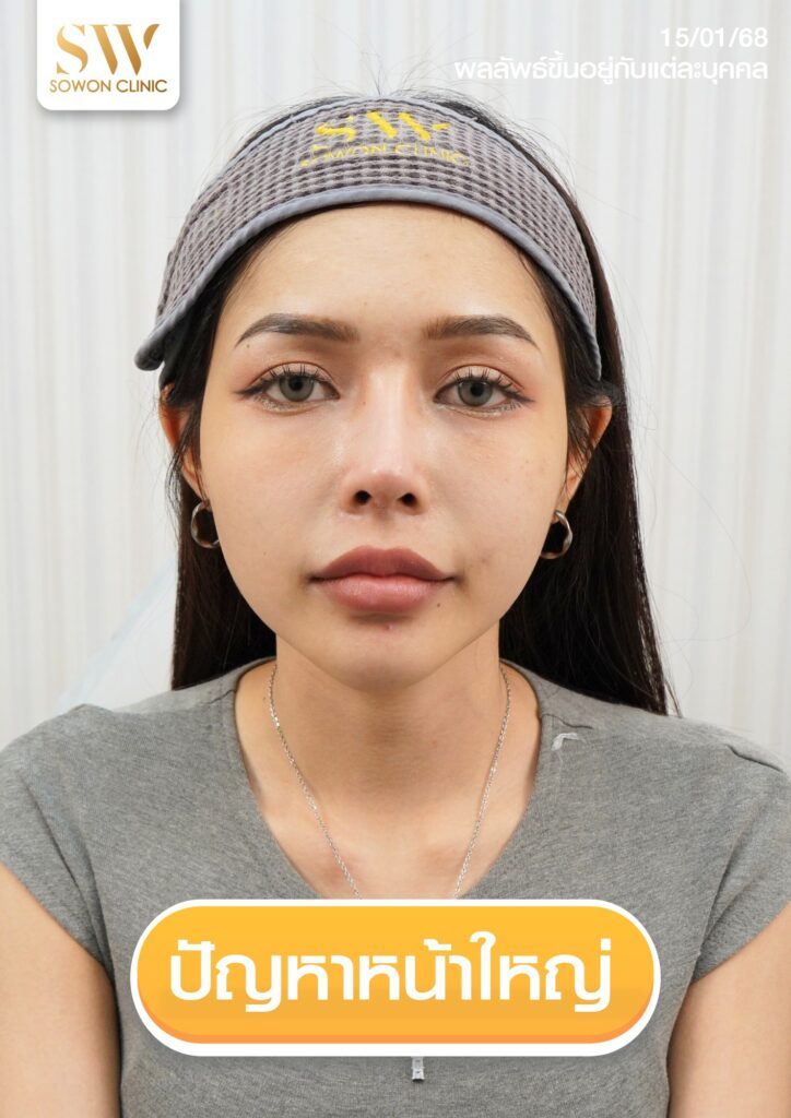 รีวืวโปรแกรมโบท็อก