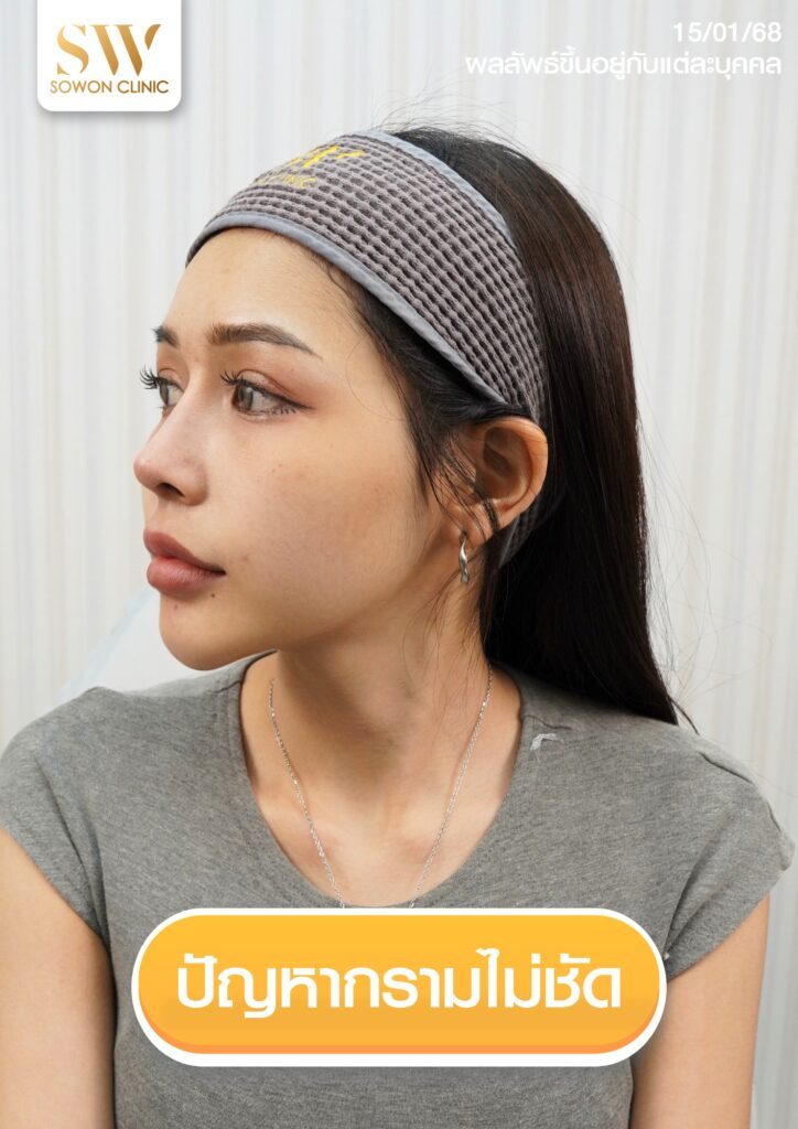 รีวืวโปรแกรมโบท็อก
