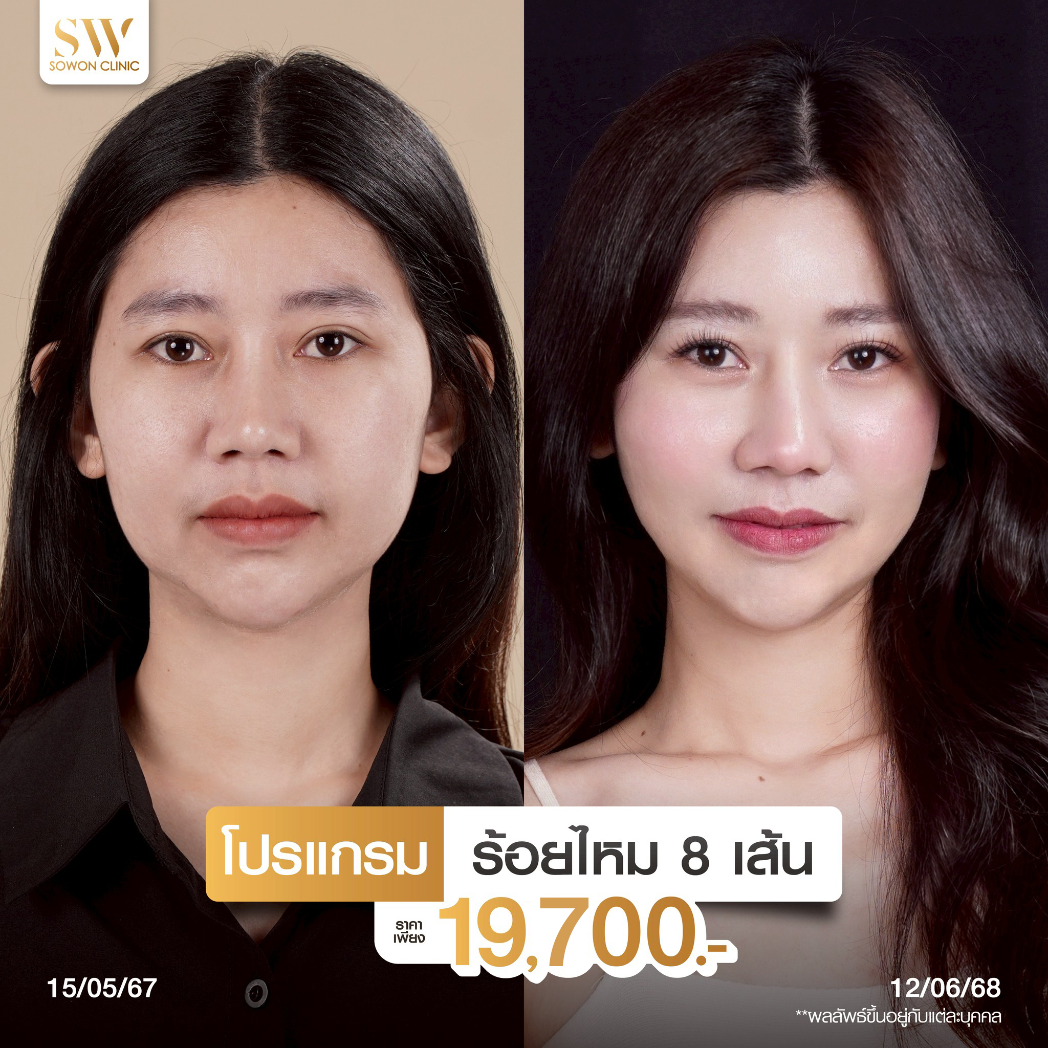 โปรโมชั่นร้อยไหมรีวิว 04