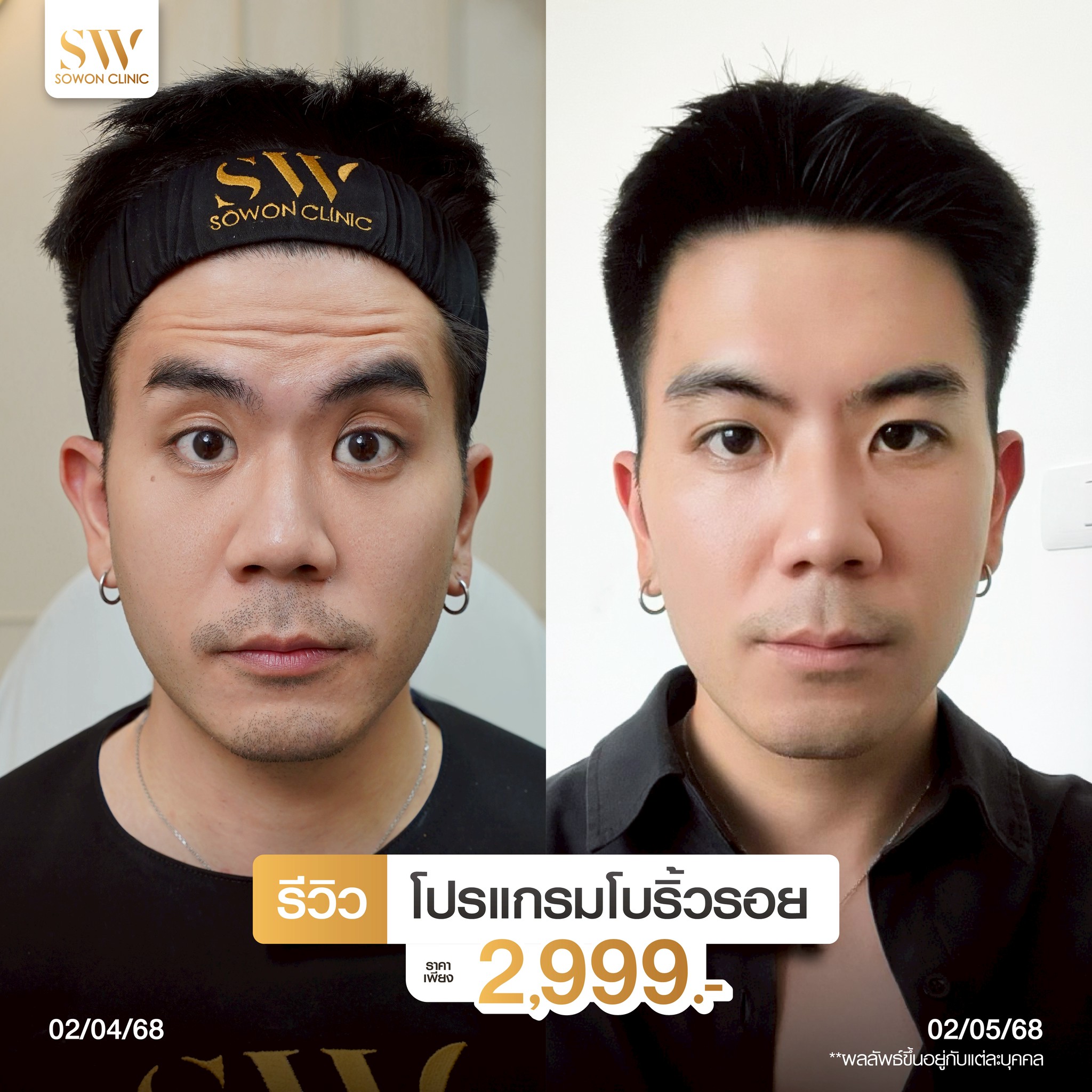 โปรโมชั่นร้อยไหมมิ้นท์ โปรโบริ้วรอย02