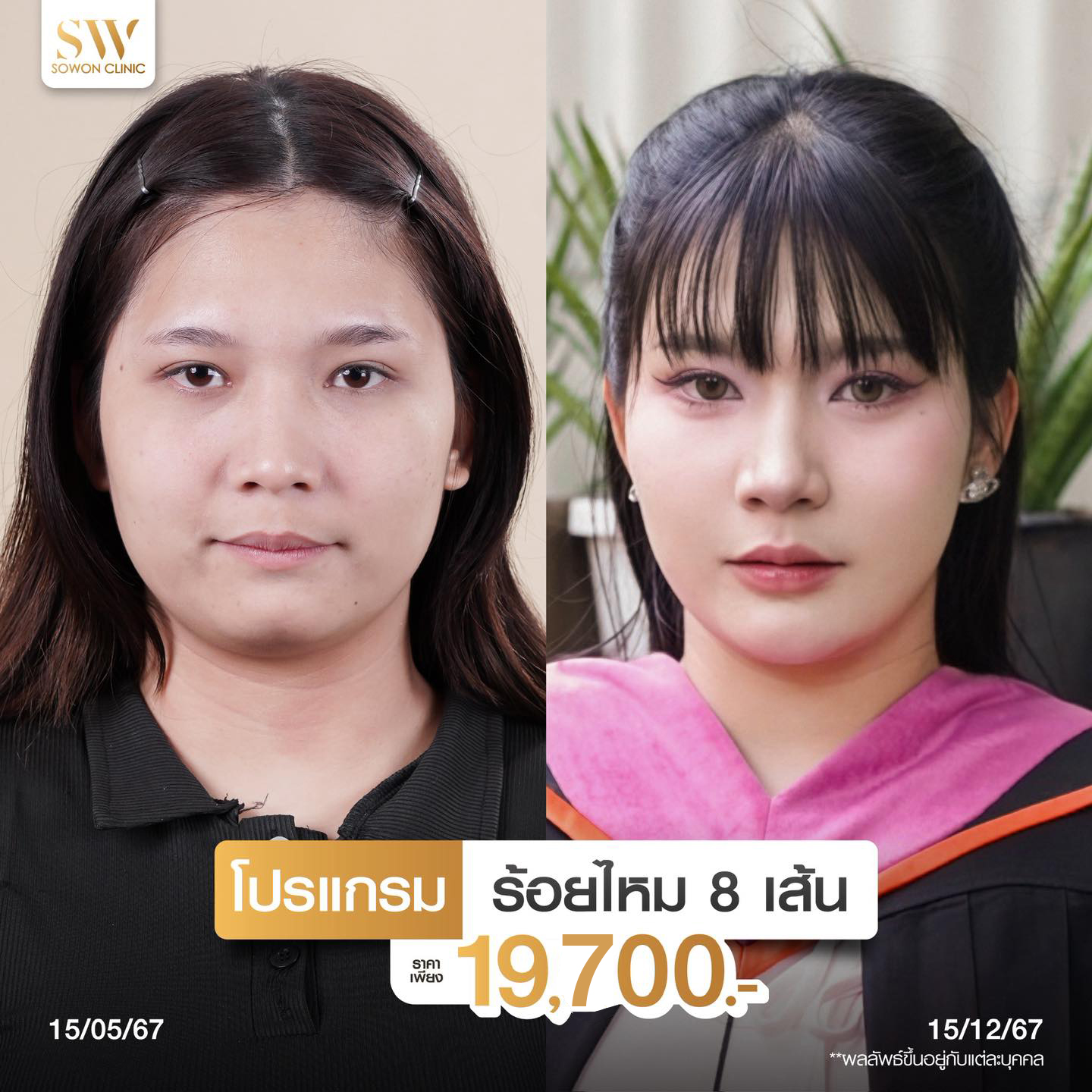 โปรโมชั่นร้อยไหมรีวิว 05