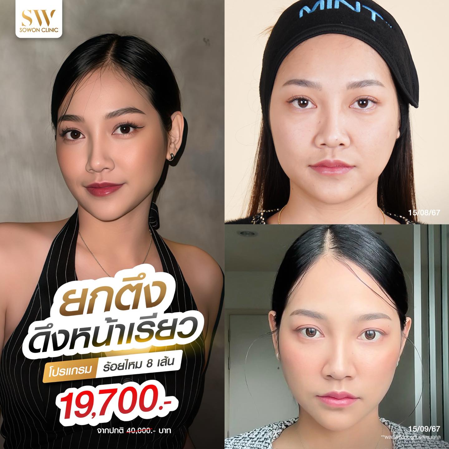 โปรโมชั่นร้อยไหมรีวิว 01
