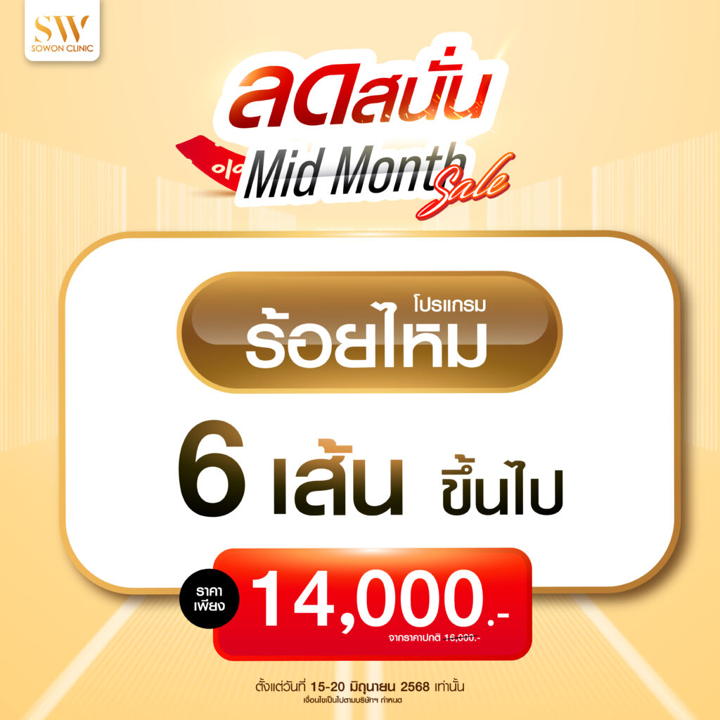 โปรแกรมลดริ้วรอย Mid month sale โปรแกรมร้อยไหมมิ้น