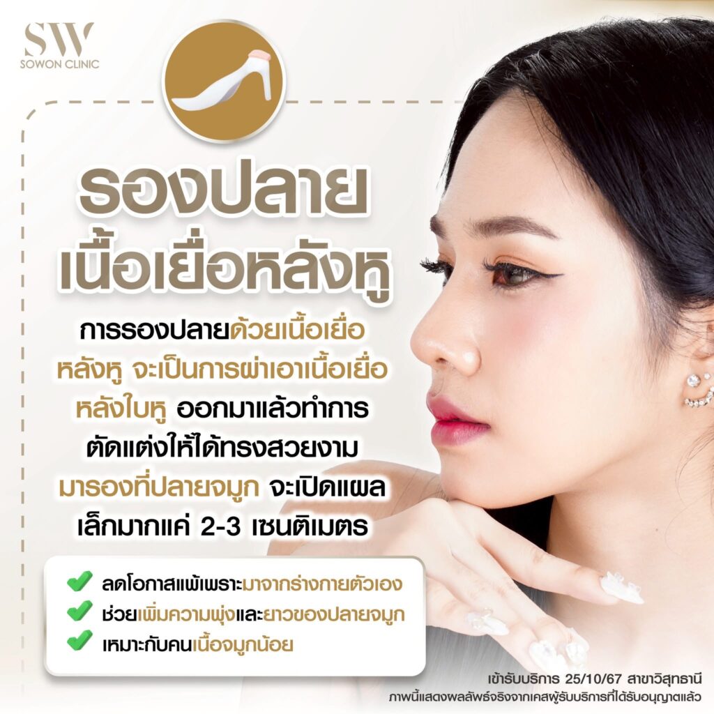 เสริมจมูกครั้งแรกที่ไหนดี รองปลายเนื้อเยื่อหลังหู