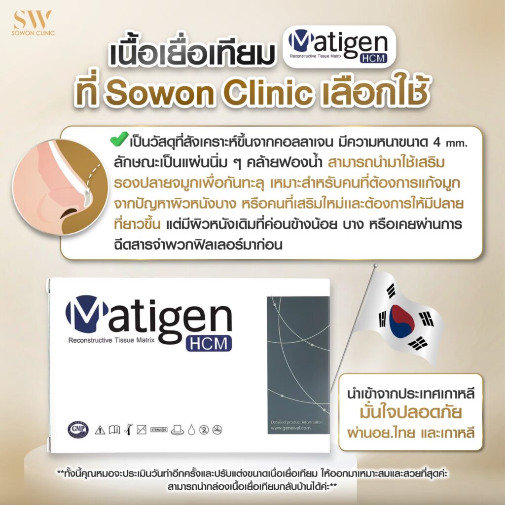 เสริมจมูกครั้งแรกที่ไหนดี เนื้อเยื่อเทียม