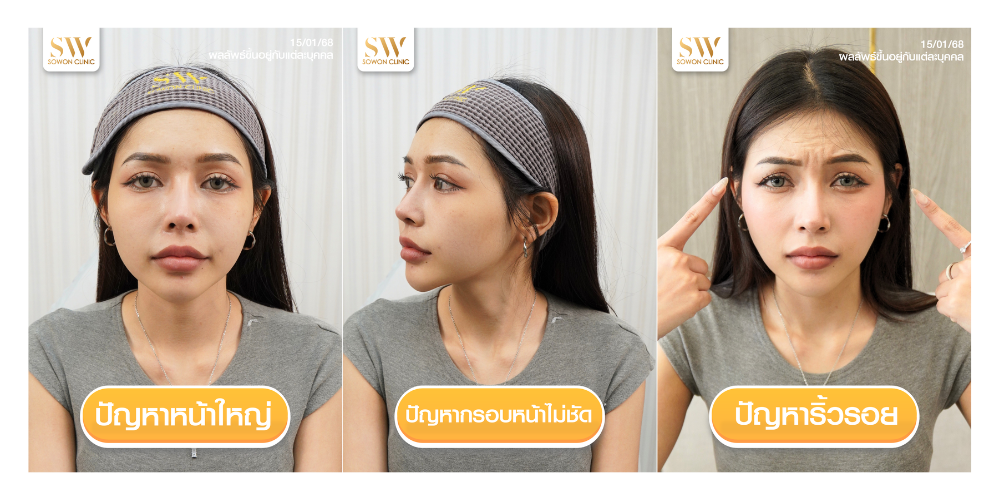 โปรโมชั่นโบสุดพิเศษ ปัญหา