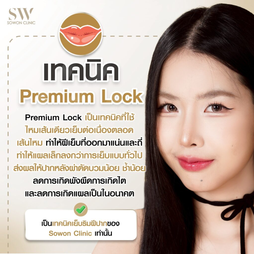 รีวิวปากกระจับ เทคนิคพรีเมียมล็อค