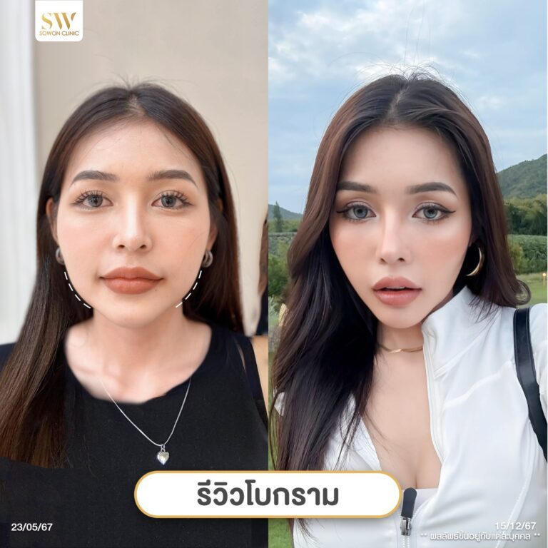 โบกรามหน้าเรียว_รีวิว