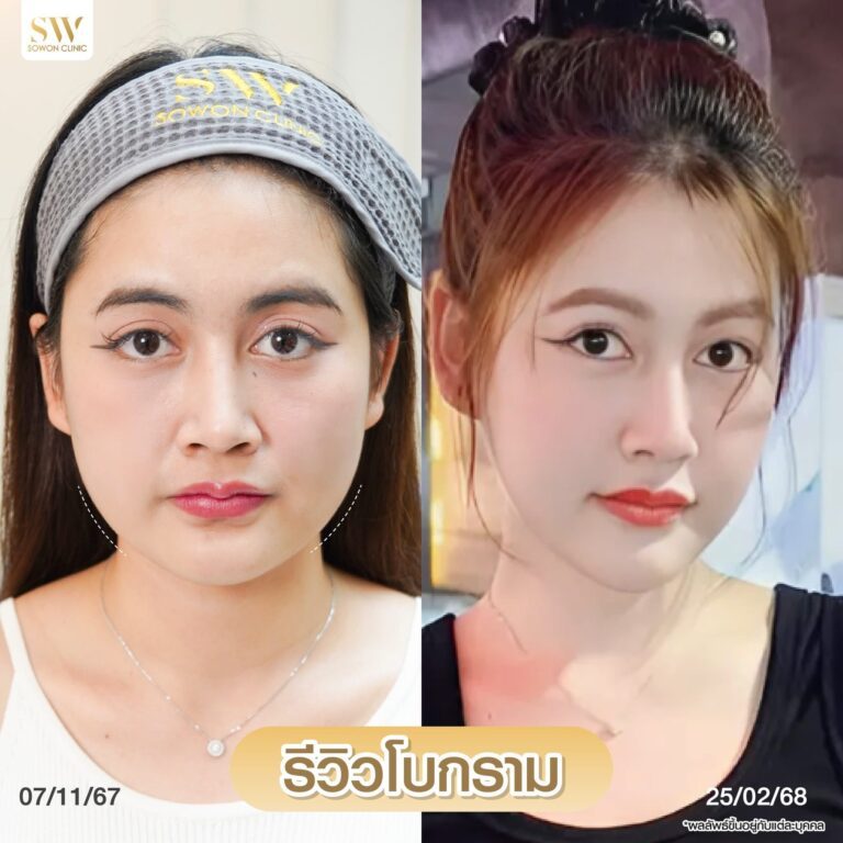 โบกรามหน้าเรียว_รีวิว01