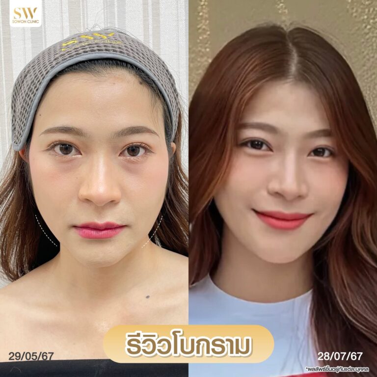 โบกรามหน้าเรียว_รีวิว02