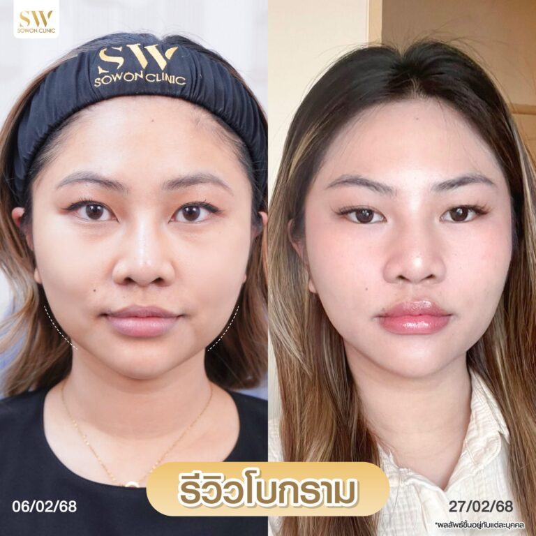 โบกรามหน้าเรียว_รีวิว04