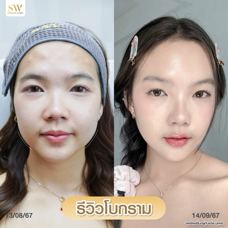 โบกรามหน้าเรียว_รีวิว05