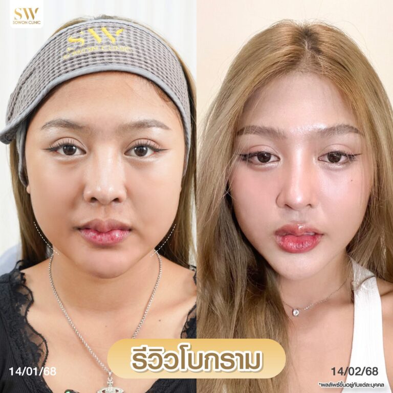 โบกรามหน้าเรียว_รีวิว06
