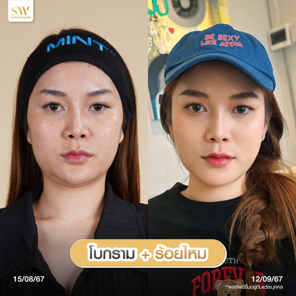 โปรโมชั่นร้อยไหมมิ้นท์-จับคู่ร้อยไหม02