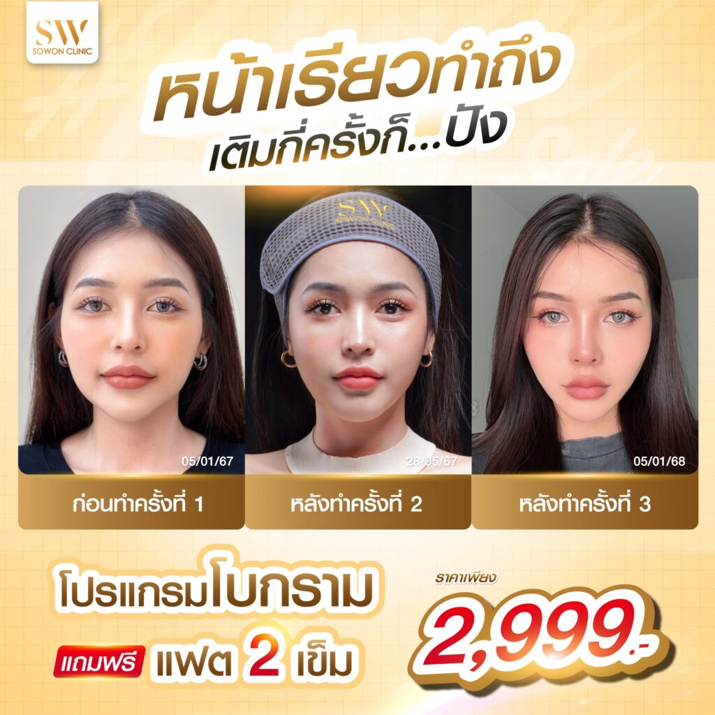 โปรแกรมลดกรามหน้าเรียว โบกรามแถมแฟต