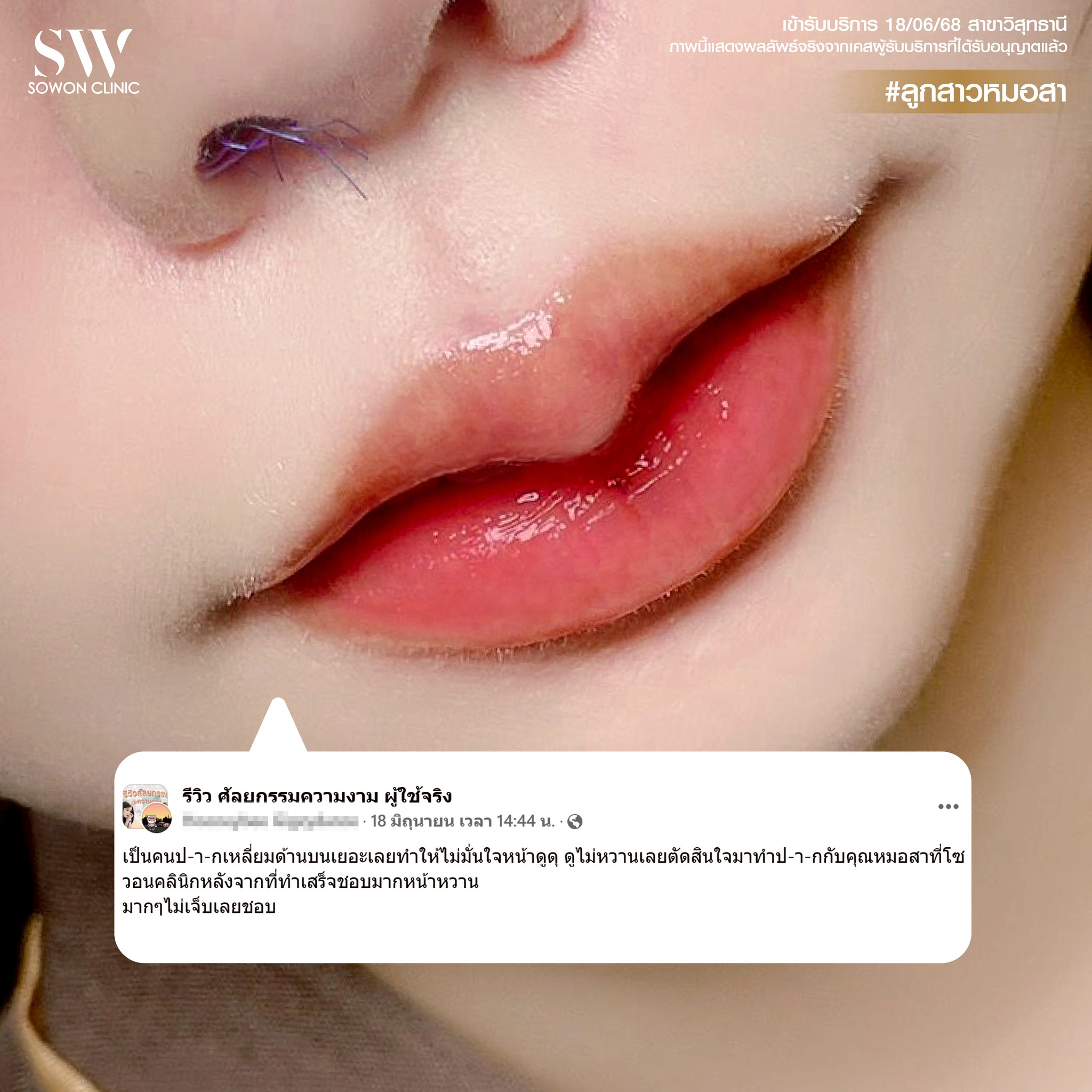 รีวิวทรงปาก01