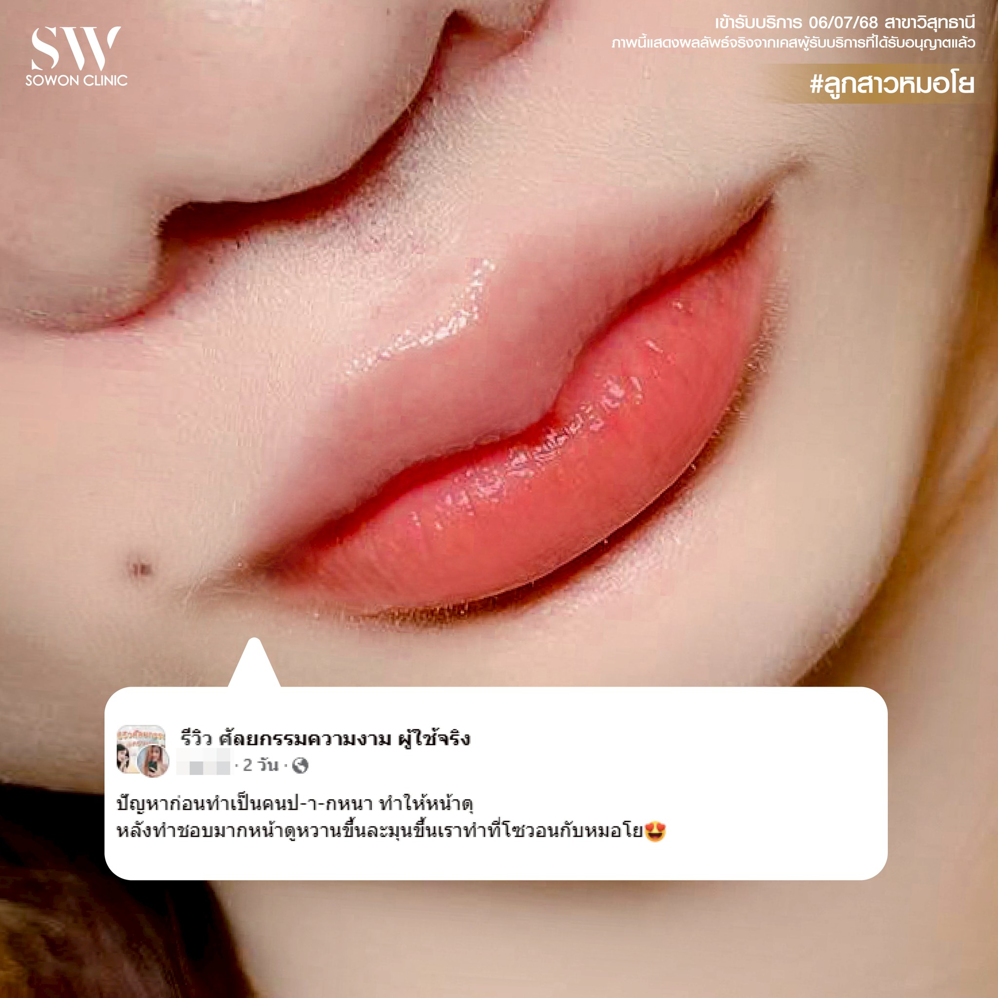 รีวิวทรงปาก02