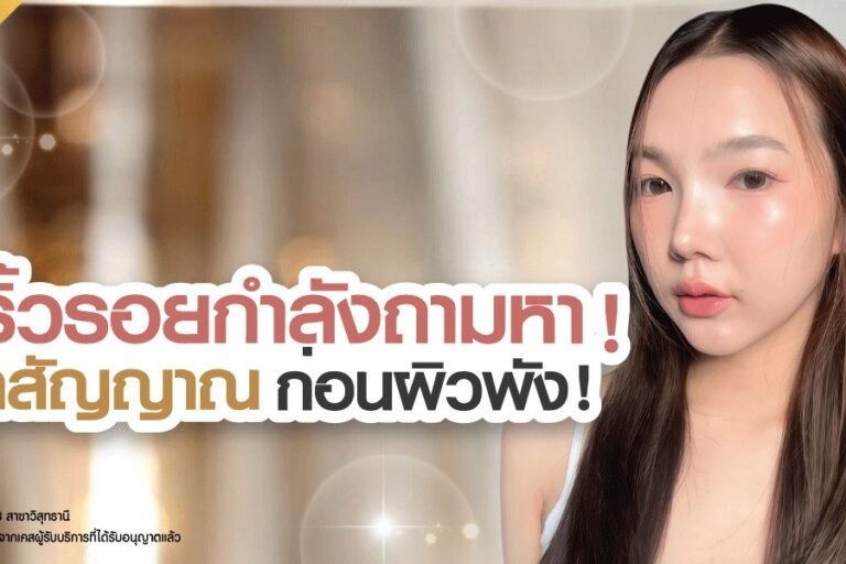 botox-reduces-wrinkles-check-signs-before-skin-damage-skin-botox-knowledge