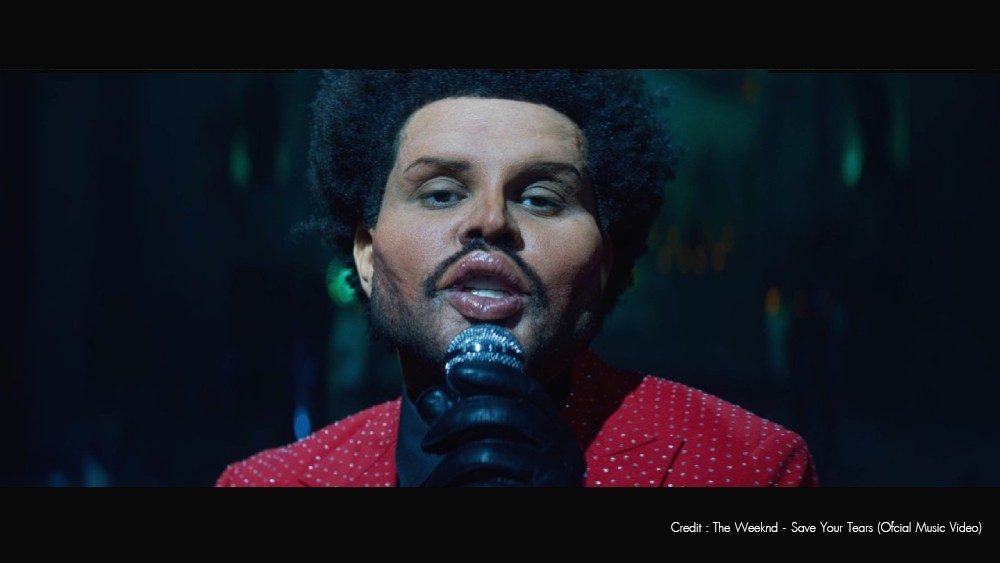 example_case_Filler Overfilled Syndrome