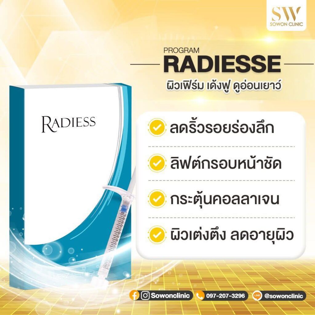 radiesse ช่วยเรื่อง