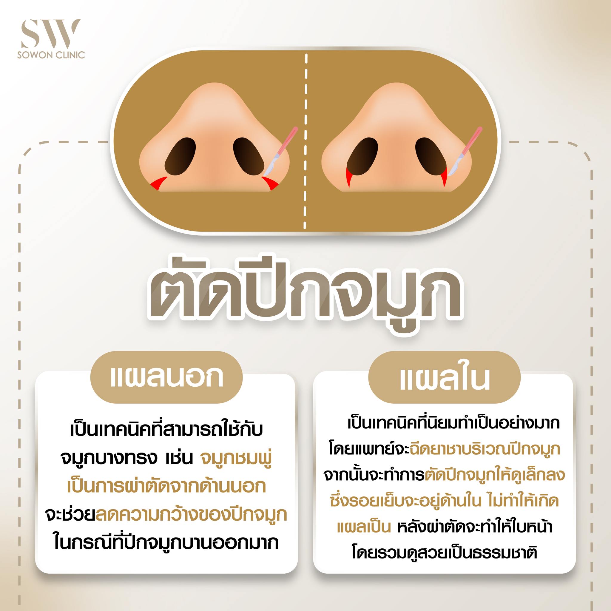 เสริมจมูกครั้งแรกต้องรู้อะไรบ้าง 01