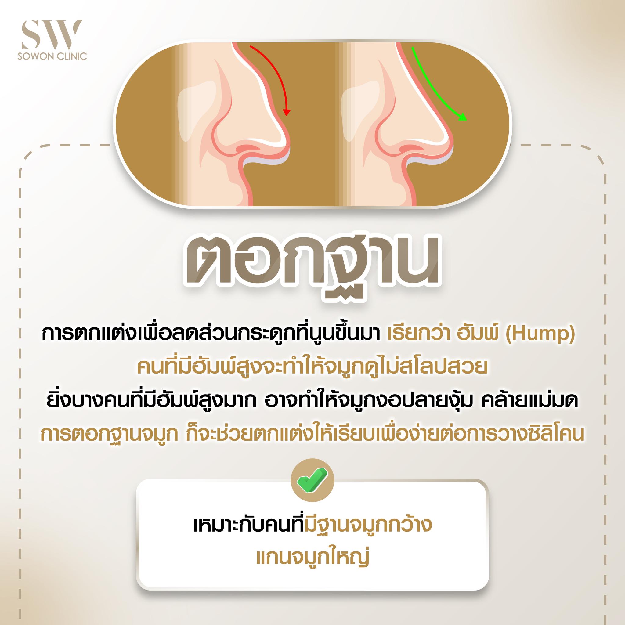เสริมจมูกครั้งแรกต้องรู้อะไรบ้าง 02