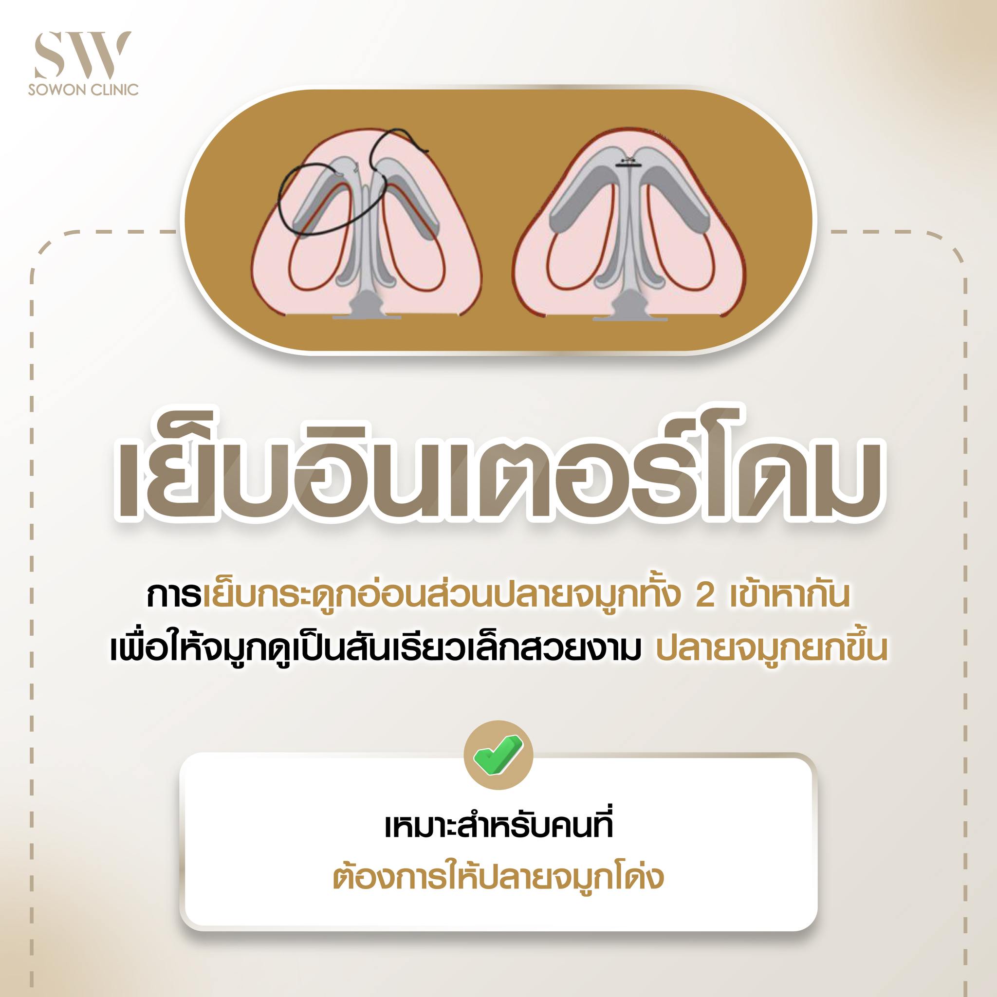 เสริมจมูกครั้งแรกต้องรู้อะไรบ้าง 04