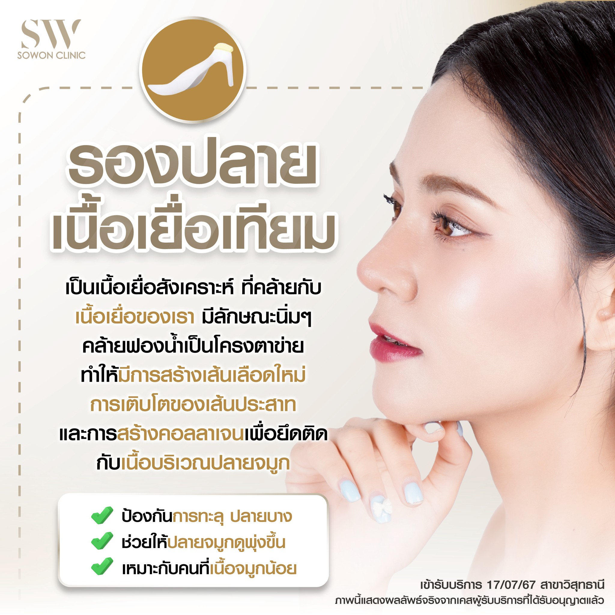 เสริมจมูกครั้งแรกต้องรู้อะไรบ้าง 05