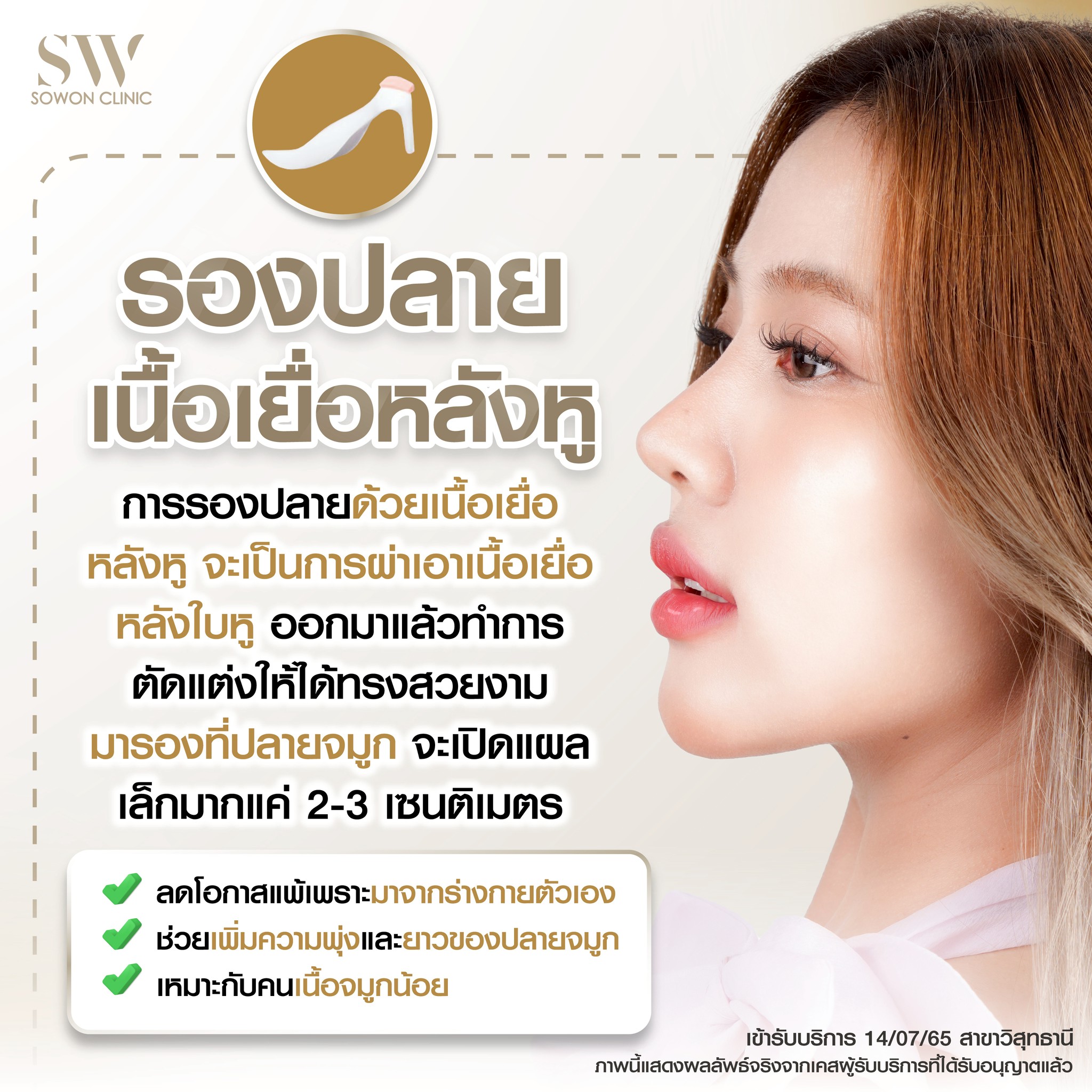 เสริมจมูกครั้งแรกต้องรู้อะไรบ้าง 06