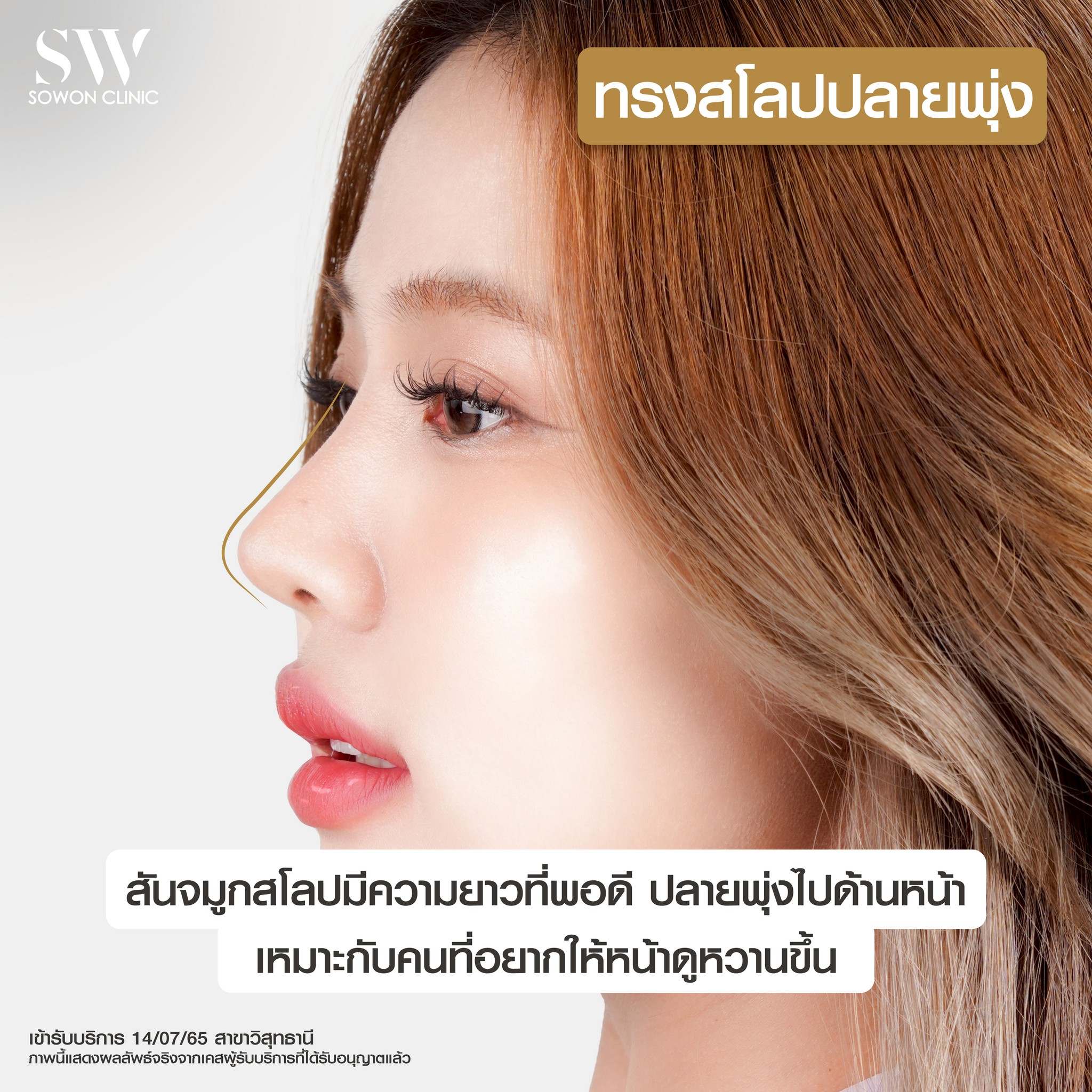 เสริมจมูกครั้งแรกต้องรู้อะไรบ้าง สโลปที่ถูกต้อง ปลายพุ่ง