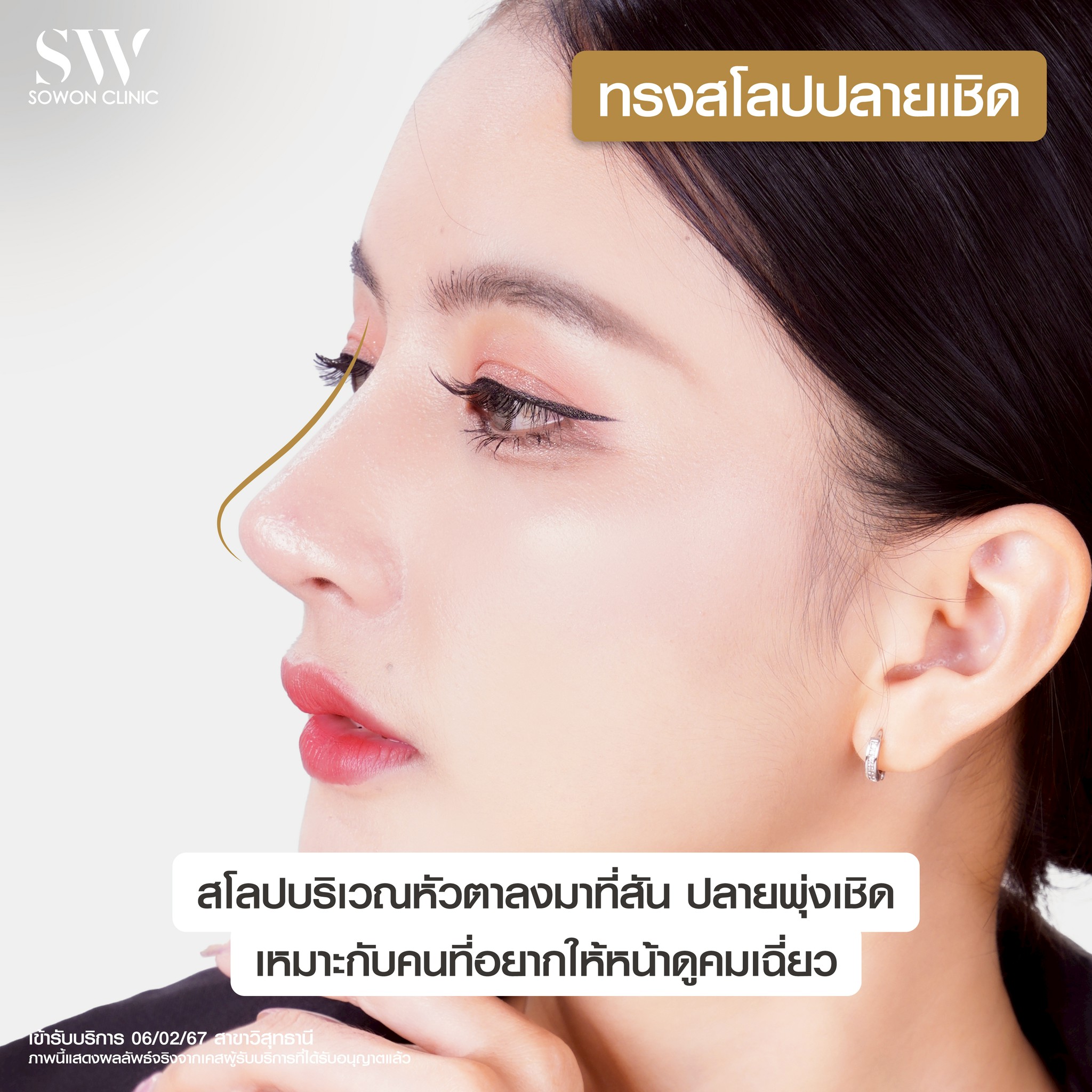 เสริมจมูกครั้งแรกต้องรู้อะไรบ้าง สโลปที่ถูกต้อง ปลายเชิด