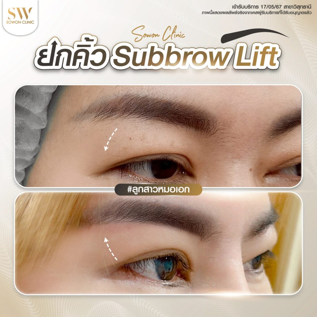 ยกคิ้ว 08