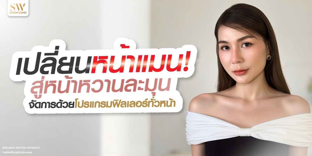 from-masculine-to-soft-look-with-full-face-filling_skin-filler_review from-masculine-to-soft-look-with-full-face-filling_skin-filler_review