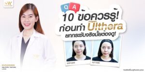 ulthera-faq-10-things-to-know-before-to-do_skin-ulthera-knowledge