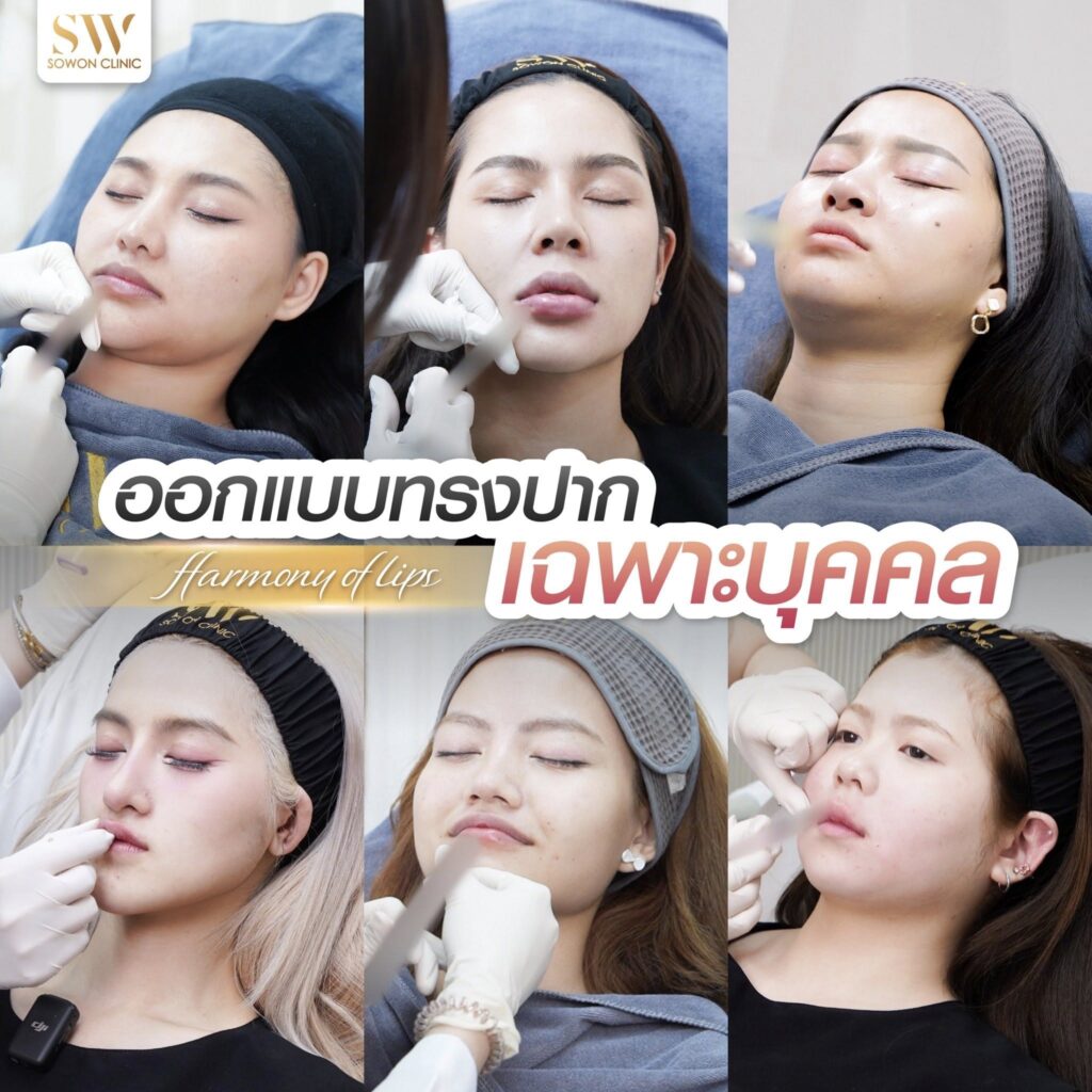 Harmony Of Lips ทรง 1