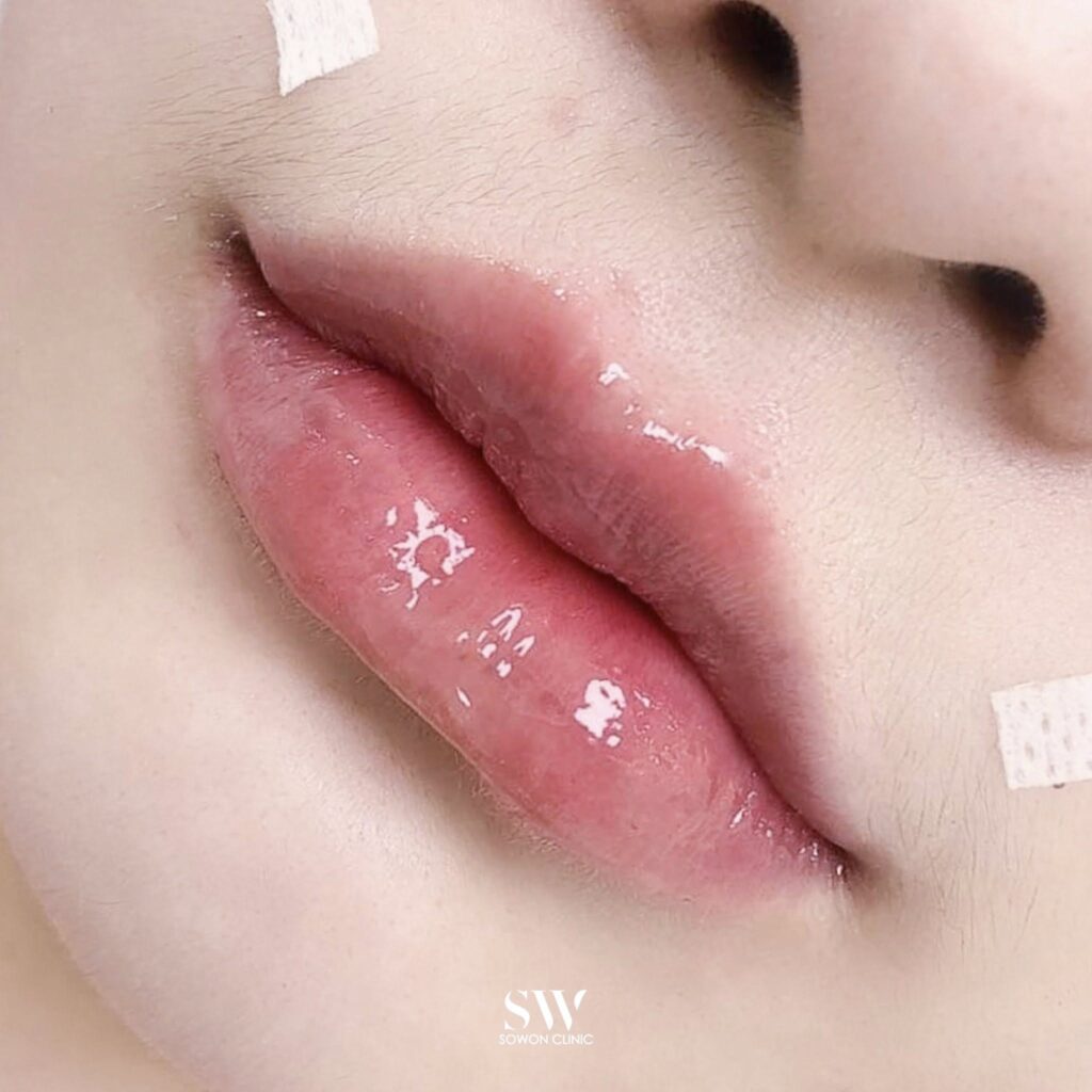 Harmony Of Lips ทรง 2