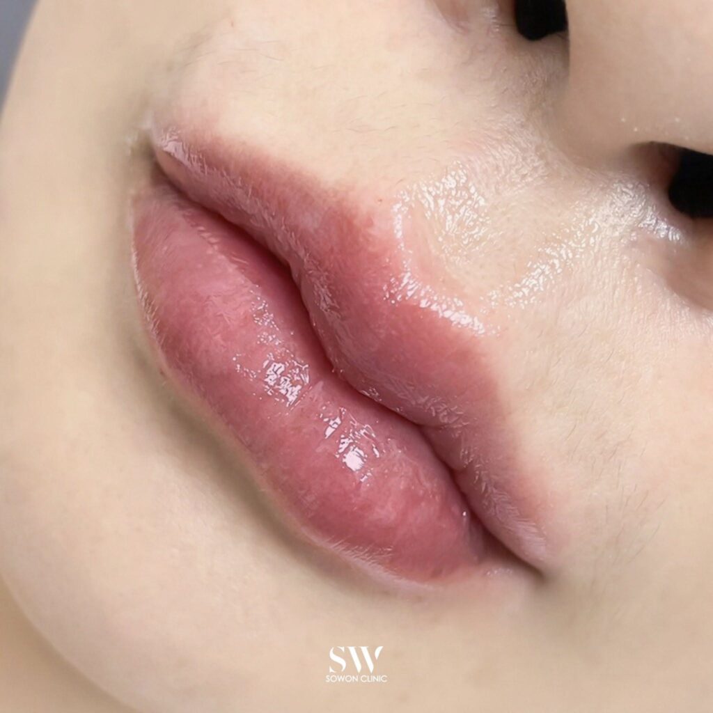 Harmony Of Lips ทรง 5