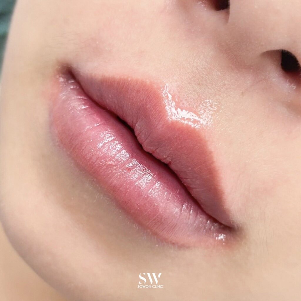 Harmony Of Lips ทรง 4