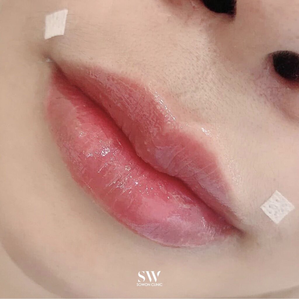 Harmony Of Lips ทรง 3