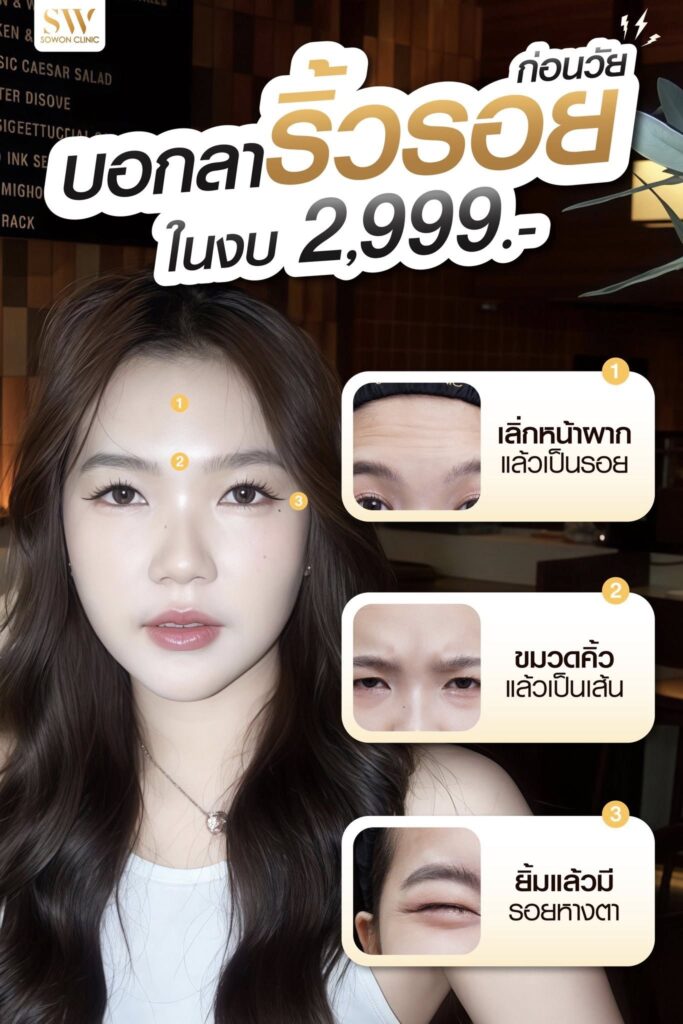 ริ้วรอยก่อนวัย