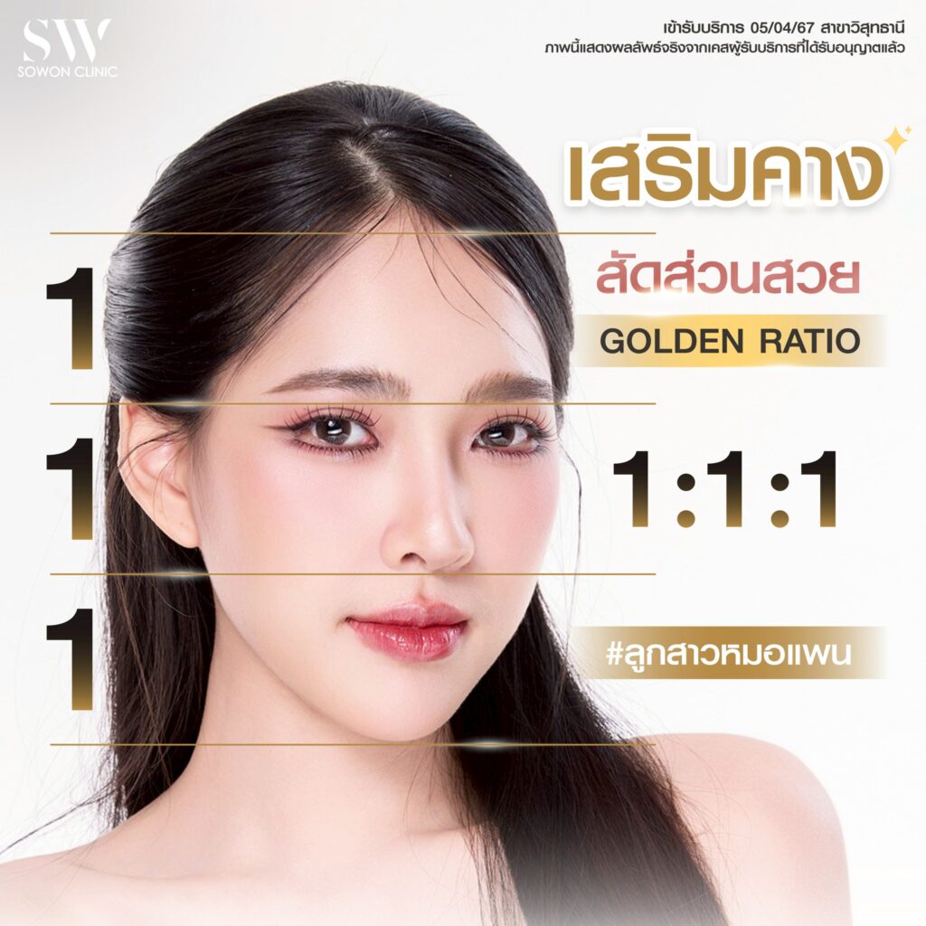 เสริมคางสัดส่วนสวย