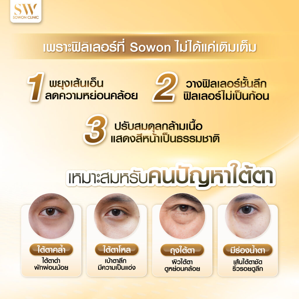 แค่เติมฟิลเลอร์ แก้ได้ 3 จุด-02