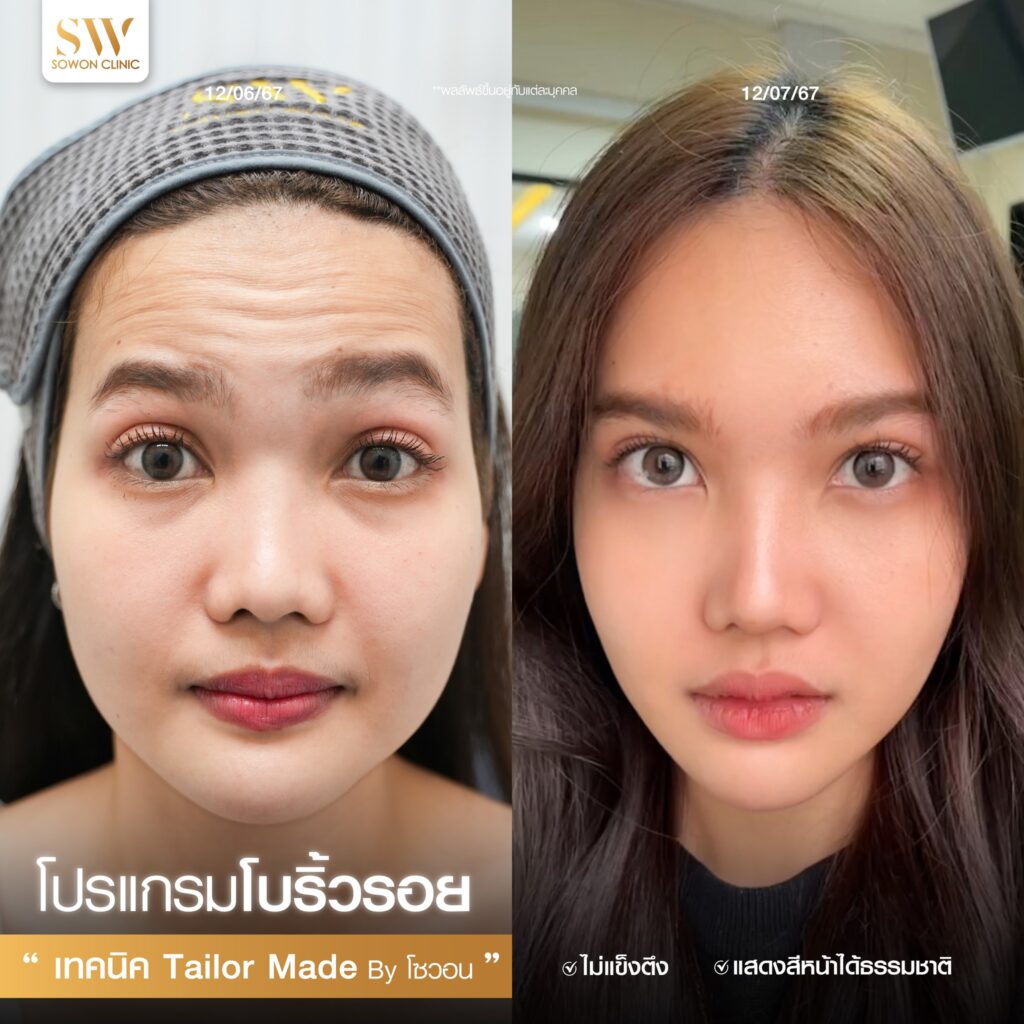 โบริ้วรอย 4