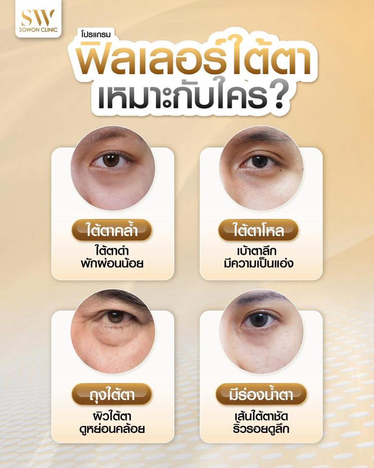 โปรแกรมฟิลเลอร์ใต้ตาเหมาะกับใครบ้าง
