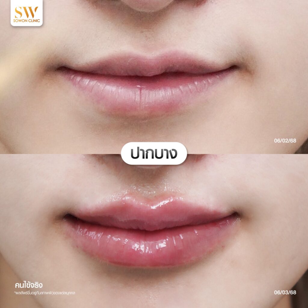 Harmony Of Lips ปากบาง